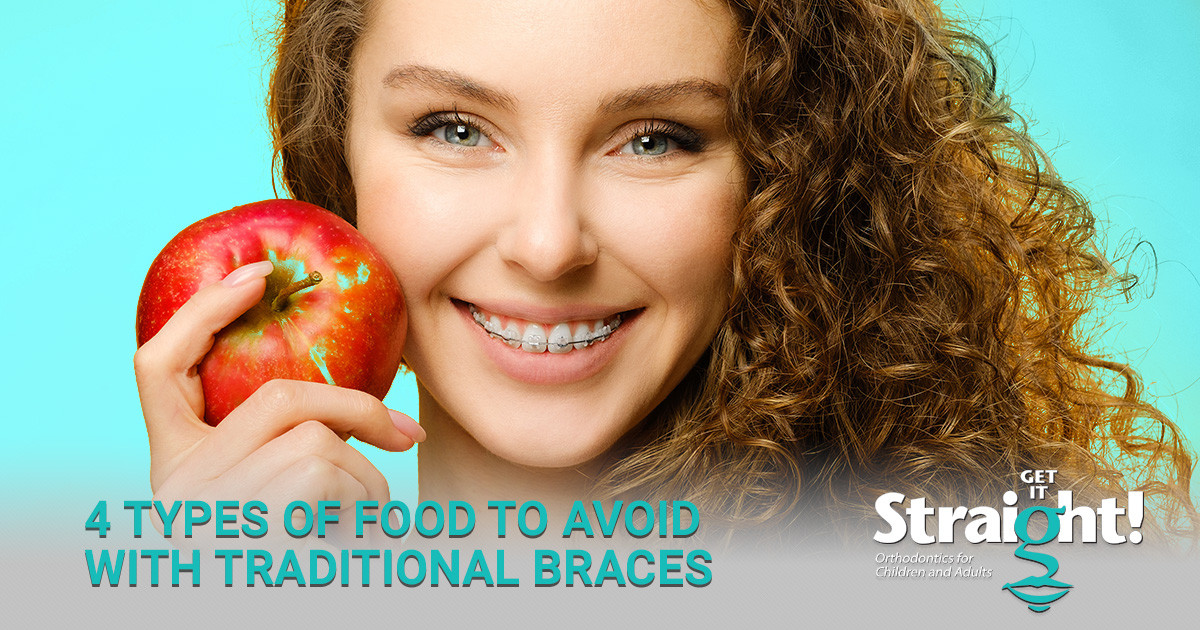 4 Types of Food to Avoid with Traditional Braces