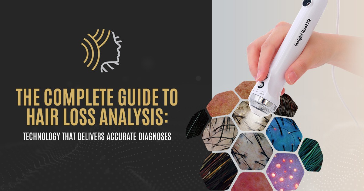 The Complete Guide to Hair Loss Analysis: Technology That Delivers Accurate Diagnoses