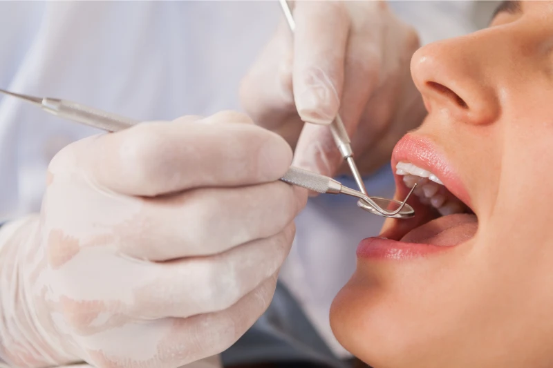 Dentist wearing gloves examining a patient’s open mouth with dental tools.