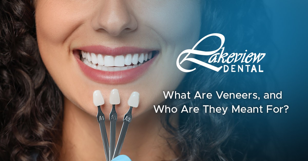 What Are Veneers, and Who Are They Meant For?