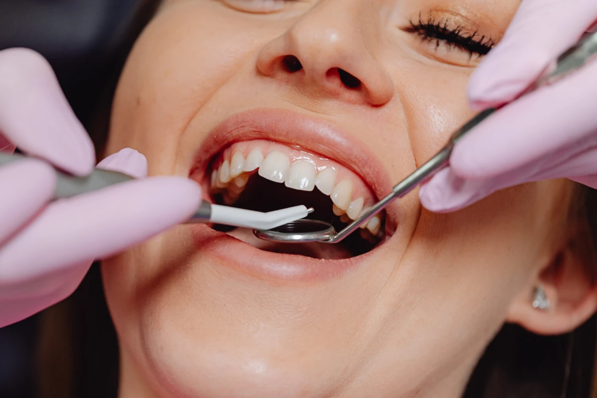 Close-up of a woman smiling during a dental checkup with dental tools in her mouth.