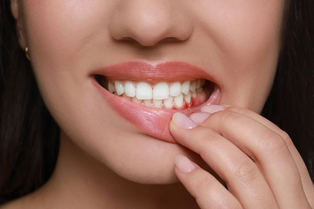 A woman pulling down her lower lip to show her teeth and gums.