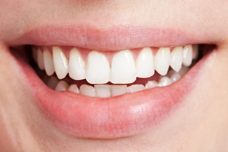 Close-up of a smiling mouth with white teeth and healthy pink lips.