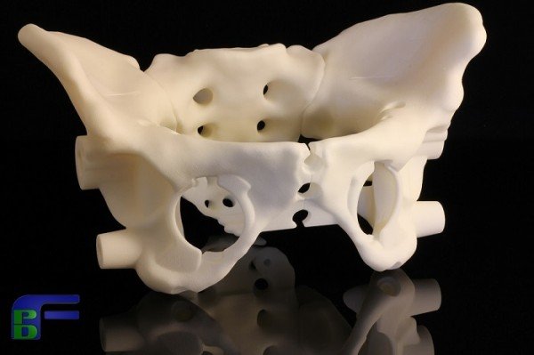 3D Printed Medical Body Part