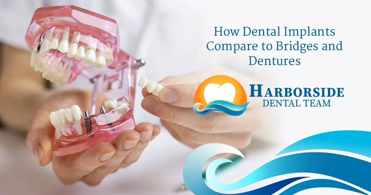 How Dental Implants Compare to Bridges and Dentures