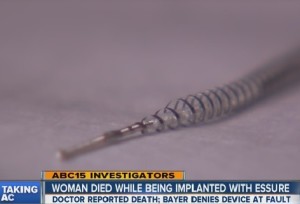 Essure Birth Control Implant